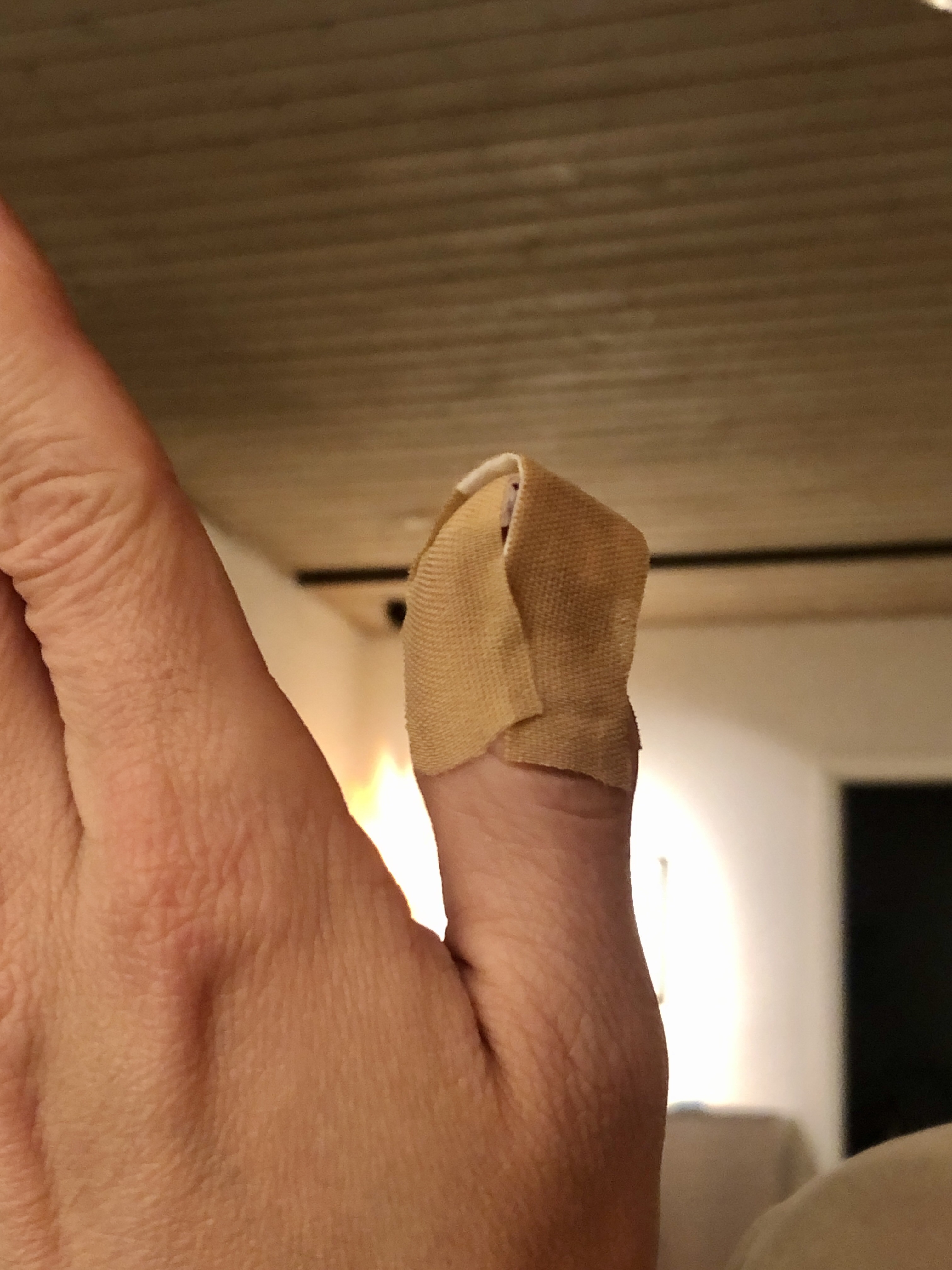 Hopefully it will stop bleeding tomorrow